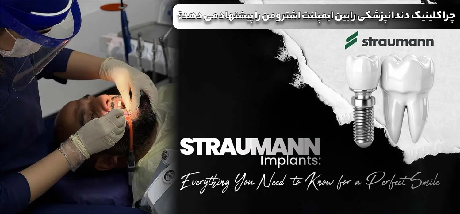 قیمت ایمپلنت اشترومن