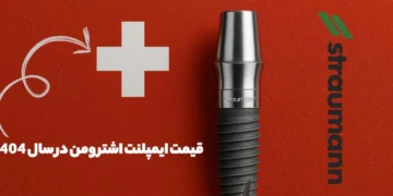 ایمپلنت اشترومن